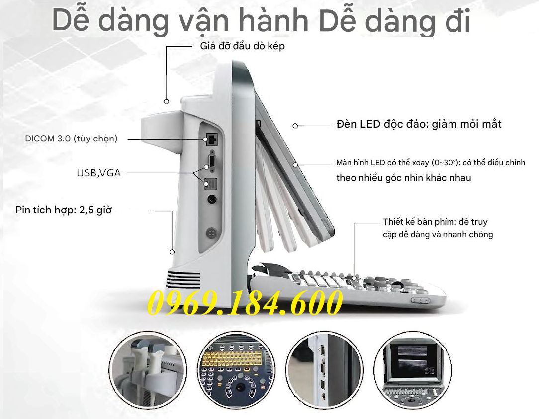 Máy siêu âm xách tay Chison ECO 6